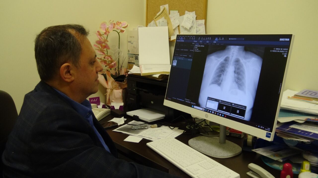 Turgut Özal Tıp Merkezi Göğüs Hastalıkları Uzmanı Prof. Dr. Talat