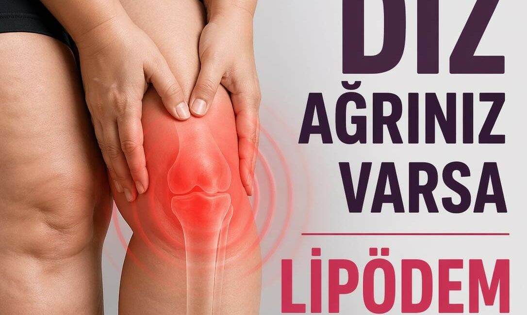 Ahmet Karacalar, lipödemin yalnızca estetik bir sorun olmadığını belirterek diz
