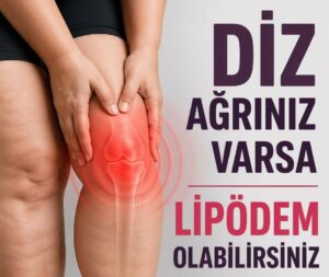 Ahmet Karacalar, lipödemin yalnızca estetik bir sorun olmadığını belirterek diz