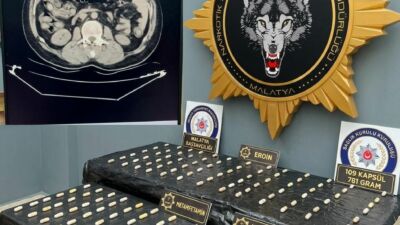 Malatya'da narkotik polisinin takibindeki 2 yabancı uyruklu şüphelinin midesinden tıbbi