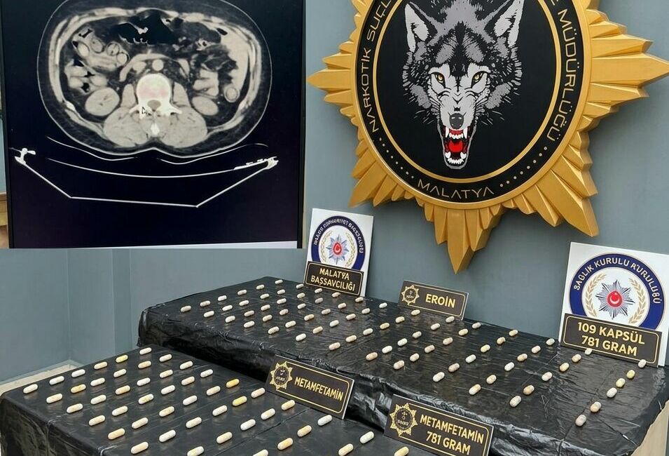 Malatya'da narkotik polisinin takibindeki 2 yabancı uyruklu şüphelinin midesinden tıbbi